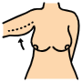 Brachioplasty icon